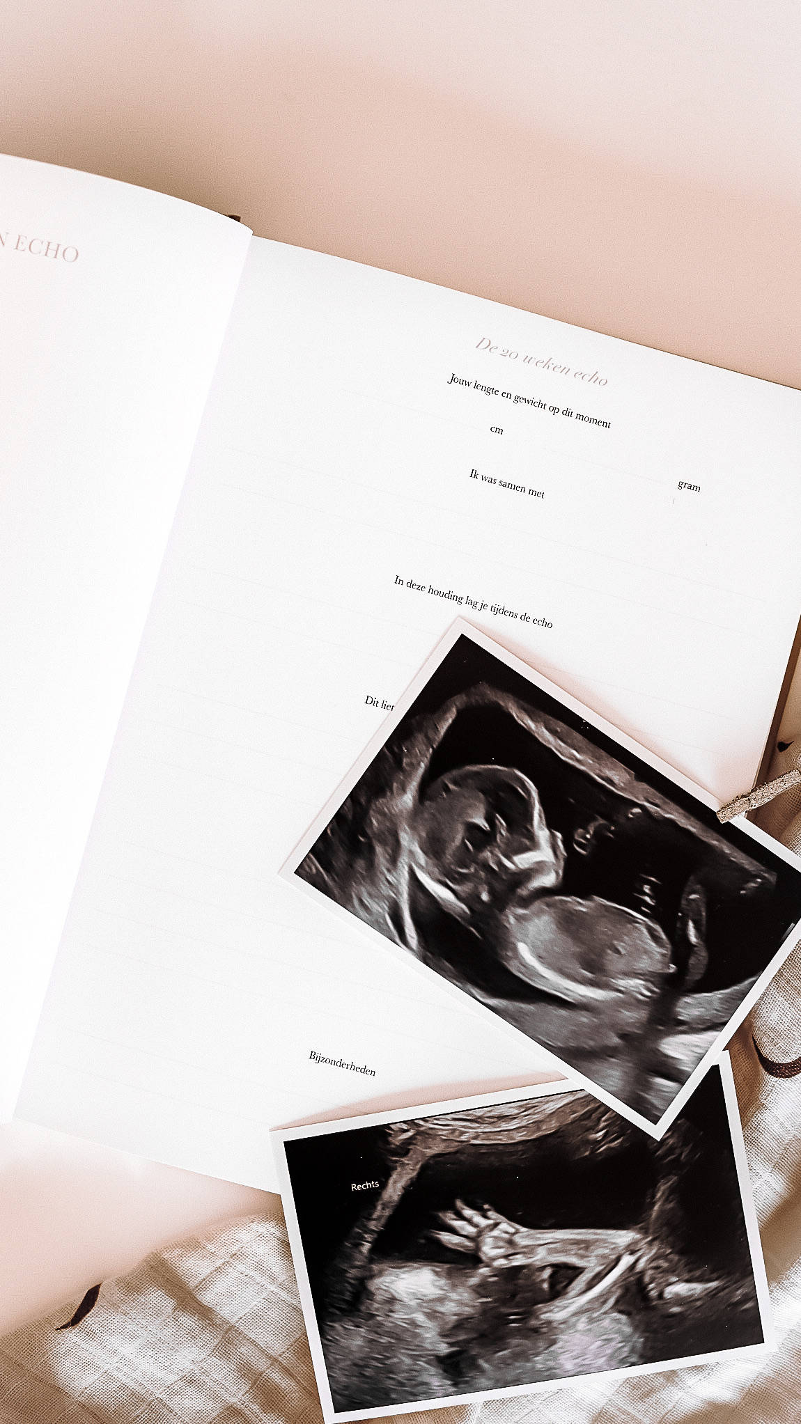 Het begin van jouw leven - Zwangerschaps- en babyinvulboek